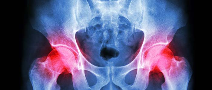 Chiropractic Charlotte NC Hip Pain Chiropractic Charlotte NC Hip Pain
